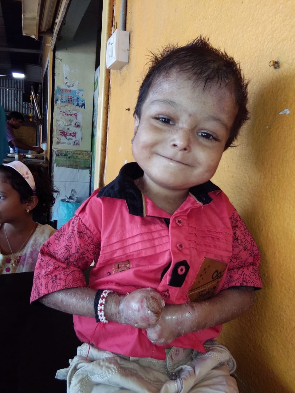 उद्या औंध जिल्हा रुग्णालयाविरोधात प्रहार अपंग क्रांती संघटनेचे आंदोलन 